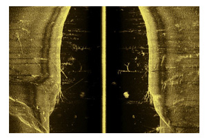 SIDESCAN IMAGING™